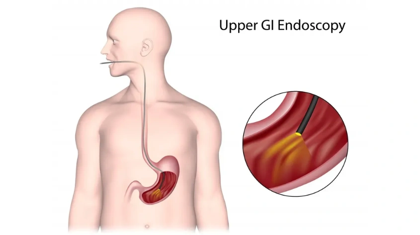 Endoscopy Services by Dr Anupama