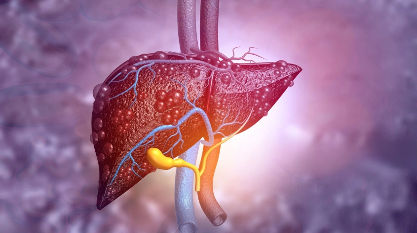 Viral hepatitis care in Hyderabad